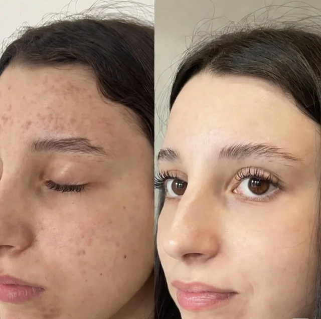 Illustrative comparison of facial skin shown side by side
